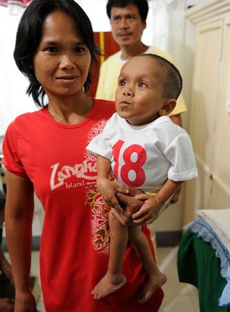 จันเรย์ บาลาวิง หนุ่มน้อยชาวฟิลิปปินส์ เจ้าของส่วนสูงแค่ 22 นิ้ว