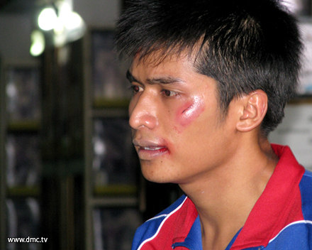 แชมป์ชีวิต  Champion
